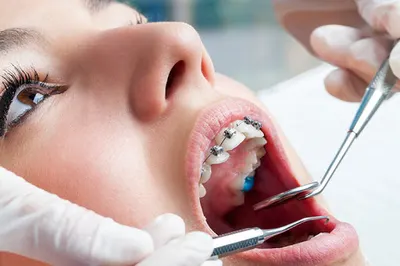 Dental Avenue | Ortodonta | Klinika Stomatologiczna | Invisalign | Implanty | Licówki | Bonding | Dentysta | Stomatologia